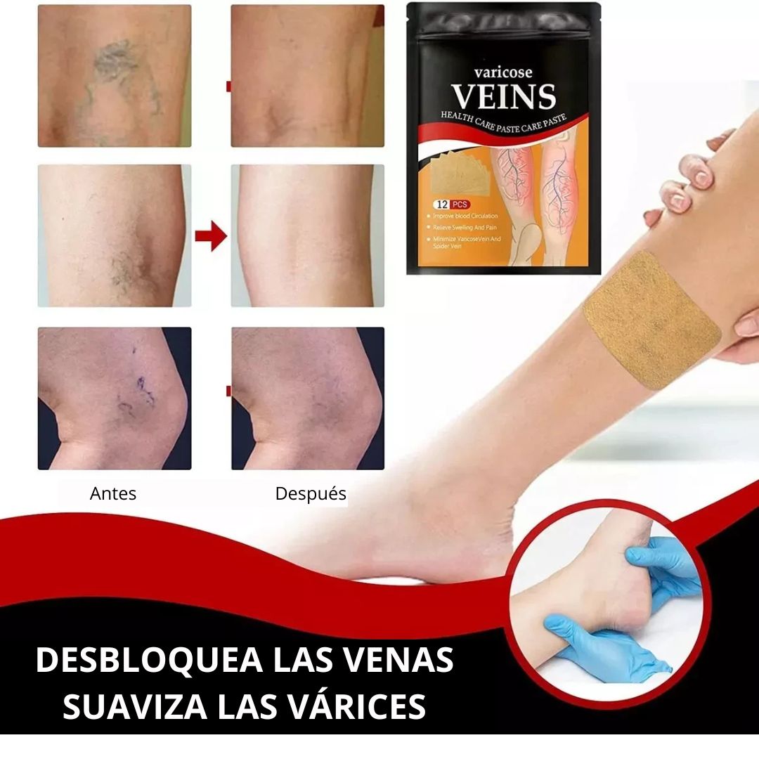 2X1 Parches para Venas Varicosas - Combate las Varices + ENVÍO GRATIS