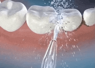 HydroSmile - LIMPIADOR IRRIGADOR DENTAL ELECTRICO - COLOR ALEATOREO