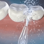 HydroSmile - LIMPIADOR IRRIGADOR DENTAL ELECTRICO - COLOR ALEATOREO