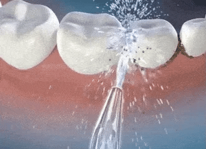 HydroSmile - LIMPIADOR IRRIGADOR DENTAL ELECTRICO - COLOR ALEATOREO – Mi tienda